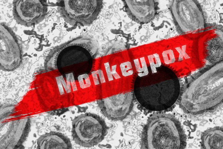 First case of monkeypox detected in Camden County